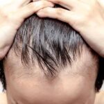 Reduce Hair Loss – Effective Home Remedies for your Hair Loss