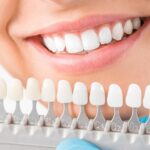 Tips to Find Affordable and Quality Dental Implants 