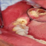 Exploring the Relationship Between General Dentistry and Overall Health