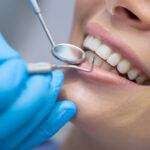 The Role of Operculectomy in Preventing Oral Infections and Discomfort in Passaic