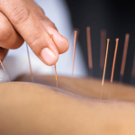 Mastering Prefilled Syringe Technique: Unleashing the Power of Specialized Training Tools