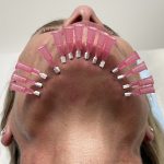 article_28426_featured_1774075583